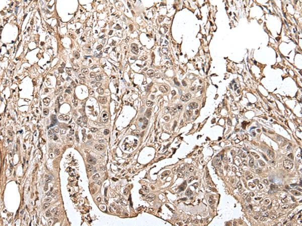 UTP3 / CRLZ1 Antibody