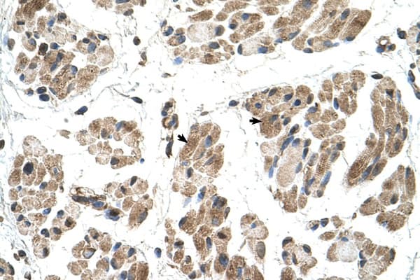 FKTN / Fukutin Antibody (aa111-160, HRP)