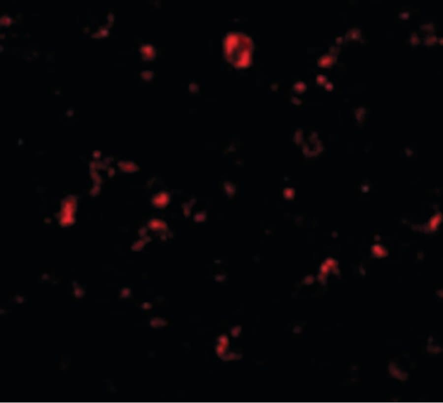 IHC-plus™ MTBP / Mdm2-Binding Protein Antibody