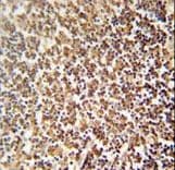 ZNF98 Antibody (aa520-549)