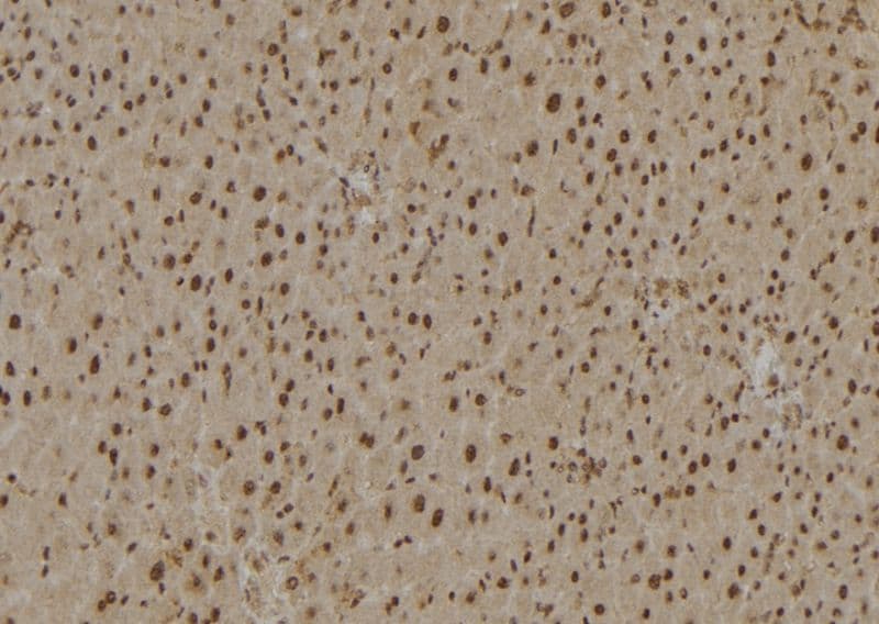 RPS27A Antibody