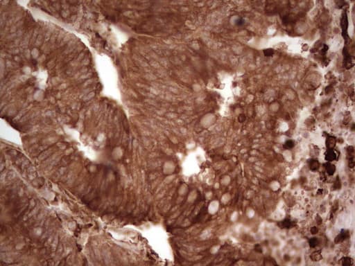 Monoclonal Mouse anti-Human MTOR Antibody (clone OTI5B8, aa1766-2144, IHC, WB)