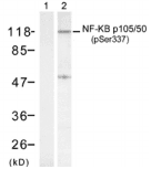 NFKB1 / NF-Kappa-B Antibody