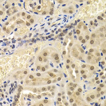 UMPS / OPRT Antibody