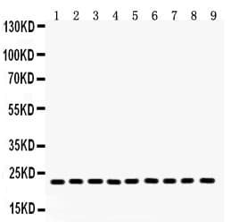 PRDX1 / Peroxiredoxin 1 Antibody (aa100-128)