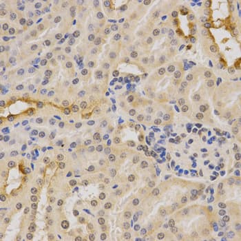 PDHA1 / PDH E1 Alpha Antibody