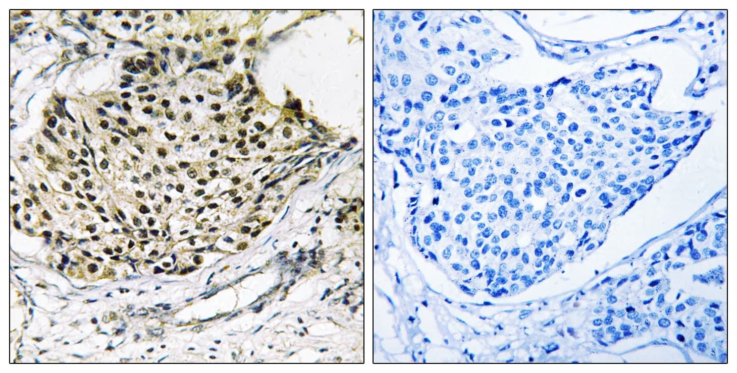 Polyclonal Rabbit anti-Human IKBKG / NEMO / IKK Gamma Antibody (phospho-Ser31, IHC, WB)