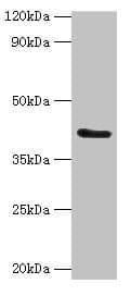 Polyclonal Rabbit anti-Human FUT6 Antibody (aa170-359, IHC, WB)