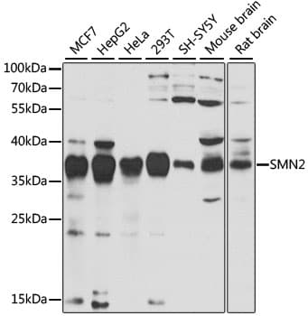SMN2 Antibody