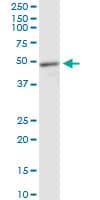 IHC-plus™ MECP2 Antibody (clone 4B6)