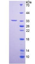Human PAL / PAM Protein (Recombinant His-T7)