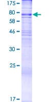 Human ALG9 Protein (Recombinant GST)