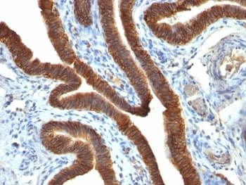 EPCAM Antibody (clone EGP40/837)