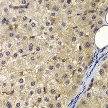 Polyclonal Rabbit anti-Human AP2A2 Antibody (IHC)