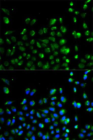 KIAA0652 / ATG13 Antibody