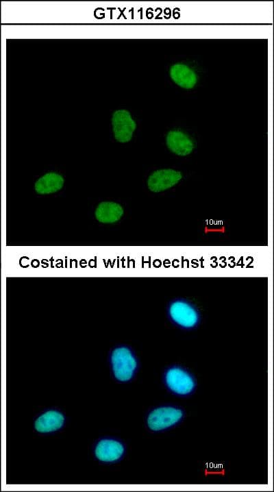 RPRD1A Antibody