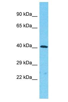 Polyclonal Rabbit anti-Human KIAA1147 Antibody (aa215-264, WB)