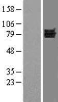 Human DVL1 / DVL / Dishevelled Protein (Over-Expression Lysate Myc-DDK (Flag))