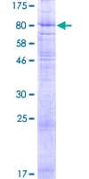 Human MFSD6L Protein (Recombinant GST)