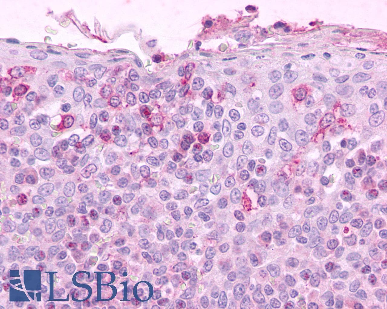 PathPlus™ CCR3 Antibody (C-Terminus)