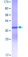 Human S100A12 Protein (Recombinant GST)
