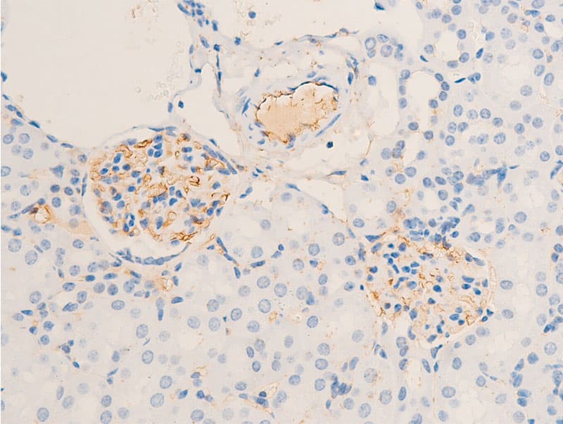 Polyclonal Rabbit anti-Human ERBB2 / HER2 Antibody (phospho-Tyr1112, IHC, IF, WB)