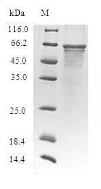 Human CLASP2 Protein (Recombinant 6His-B2M, N-terminus)