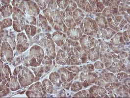 Monoclonal Mouse anti-Human MAP2K3 / MEK3 / MKK3 Antibody (clone OTI6C6, IHC, IF, WB)