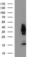 EPCAM Antibody (clone OTI2D9)
