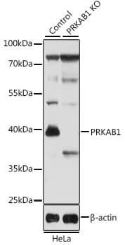 PRKAB1 / AMPK Beta 1 Antibody