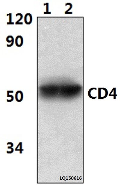 Monoclonal Mouse anti-Human CD4 Antibody (WB)