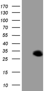 ANGPTL8 / Betatrophin Antibody (aa22-198, clone OTI6F7, Carrier-free)