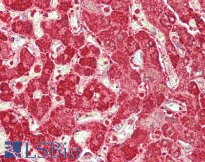 IHC-plus™ FH / Fumarase / MCL Antibody (clone 3E7)