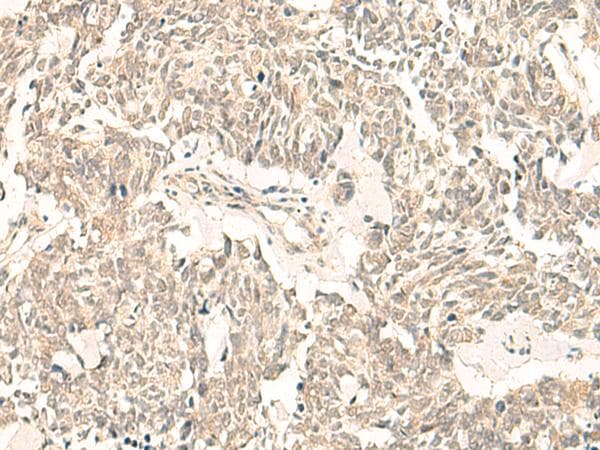 Polyclonal Rabbit anti-Human PSF1 / GINS2 Antibody (IHC)