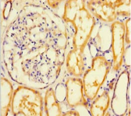 RTN4RL1 / NGRH2 Antibody