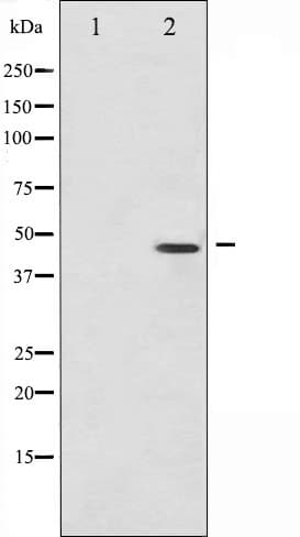 JUN / c-Jun Antibody (phospho-Ser73)