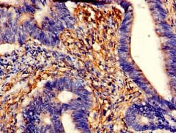 TPM3 Antibody