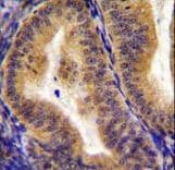 IL6ST / CD130 / gp130 Antibody (aa871-899)
