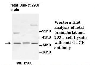 Polyclonal Rabbit anti-Human CTGF Antibody (IHC, WB)