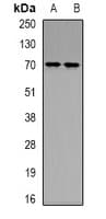 XRCC6 / Ku70 Antibody (Acetyl-Lys539)
