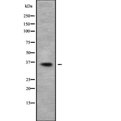HOXD9 Antibody