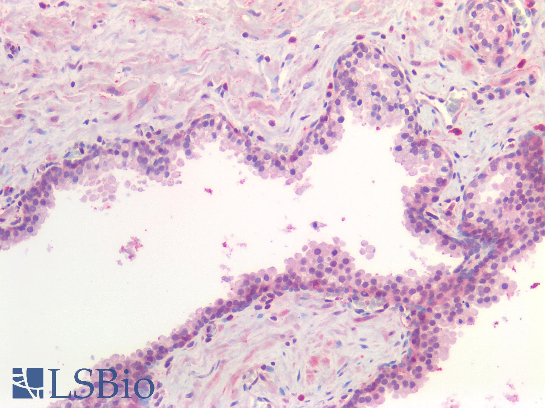 IHC-plus™ Polyclonal Rabbit anti-Human ER Alpha / Estrogen Receptor Antibody (IHC)