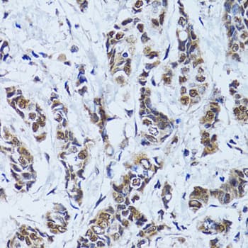 Polyclonal Rabbit anti-Human TP53BP1 / 53BP1 Antibody (IHC, IF, WB)