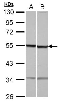 Polyclonal Rabbit anti-Human TUBB1 / Tubulin Beta 1 Antibody (WB)