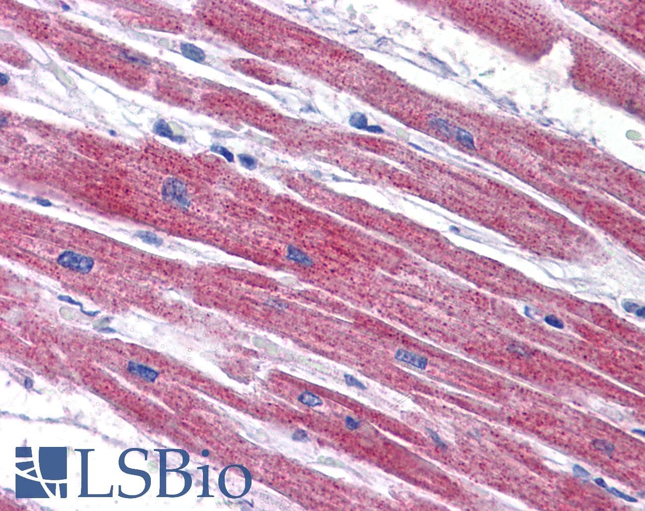 IHC-plus™ Polyclonal Rabbit anti-Human NDUFAF2 / NDUFA12L Antibody (IHC, IF, WB)