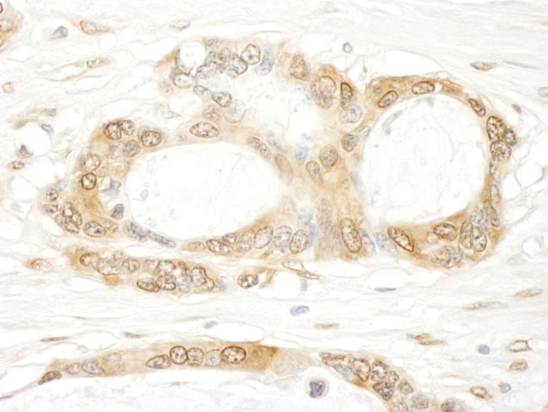 IHC-plus™ YAP / YAP1 Antibody (aa350-400)