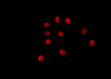 ETV6 / TEL Antibody