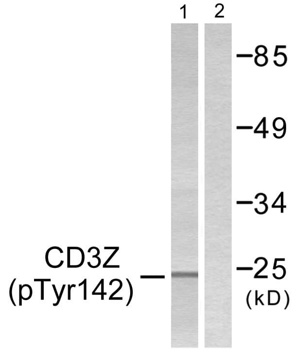 CD247 / CD3 Zeta Antibody (phospho-Tyr142)