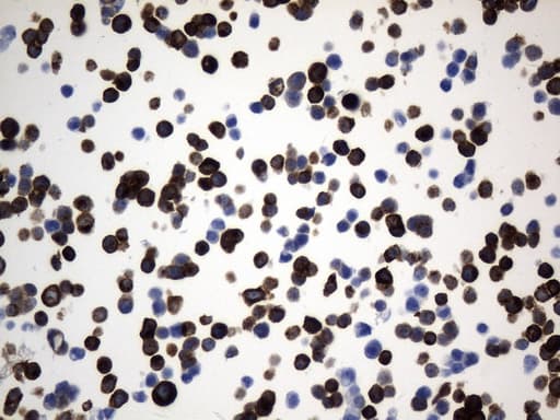 CD74 / CLIP Antibody (clone UMAB231)