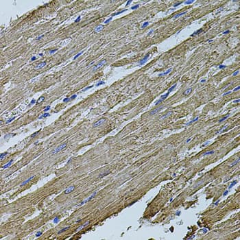 MAP1B Antibody